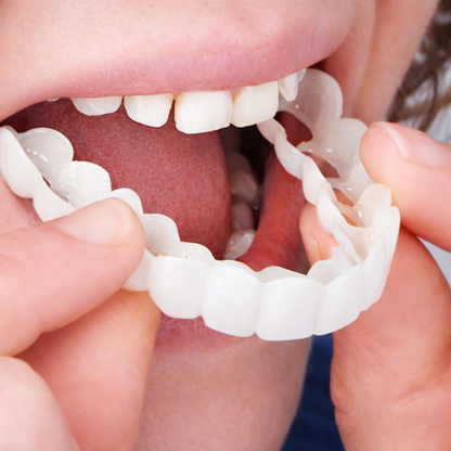 Tooth Veneers Aesthetic Covers Upper Lower