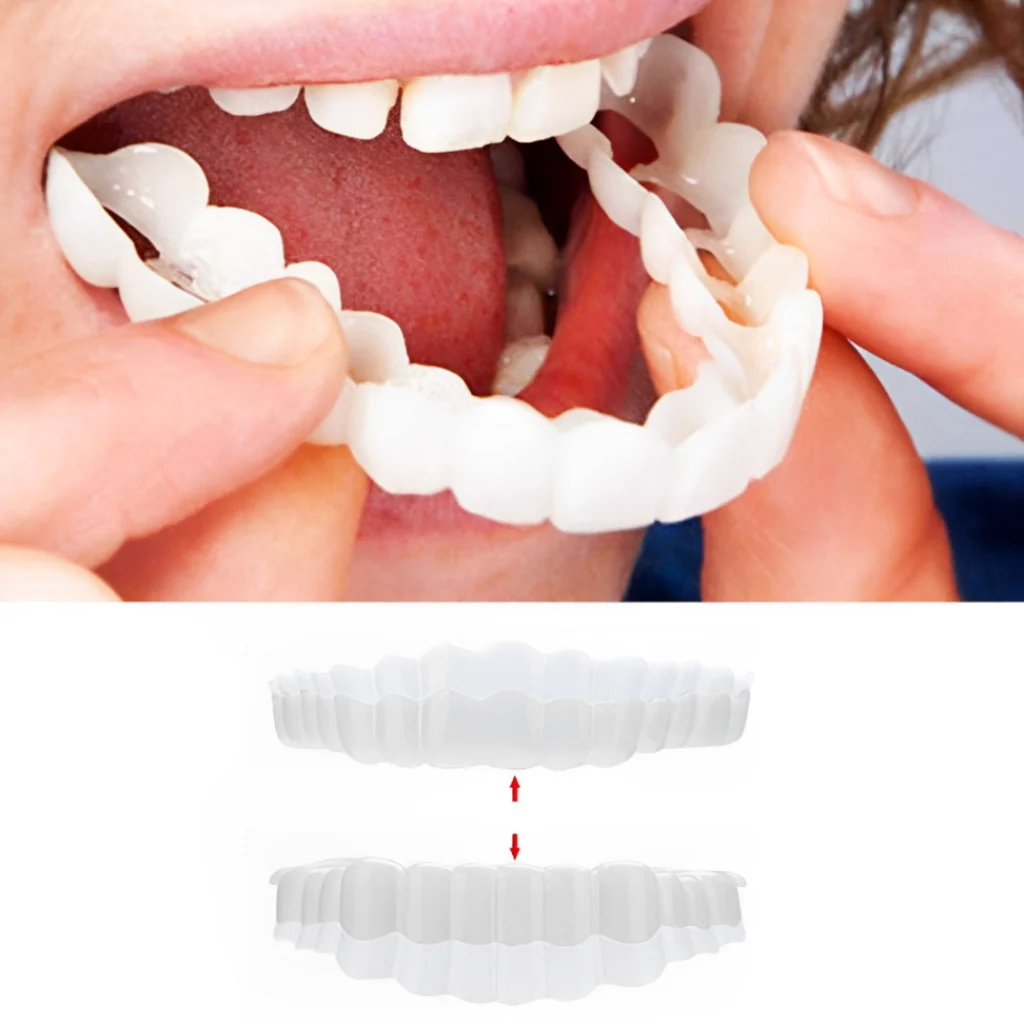 Dental Veneers Snap Teeth Veneers Smile Set - Image 1